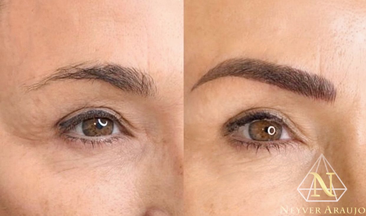 Resultado antes y despu&eacute;s — Cejas & Micropigmentaci&oacute;n
