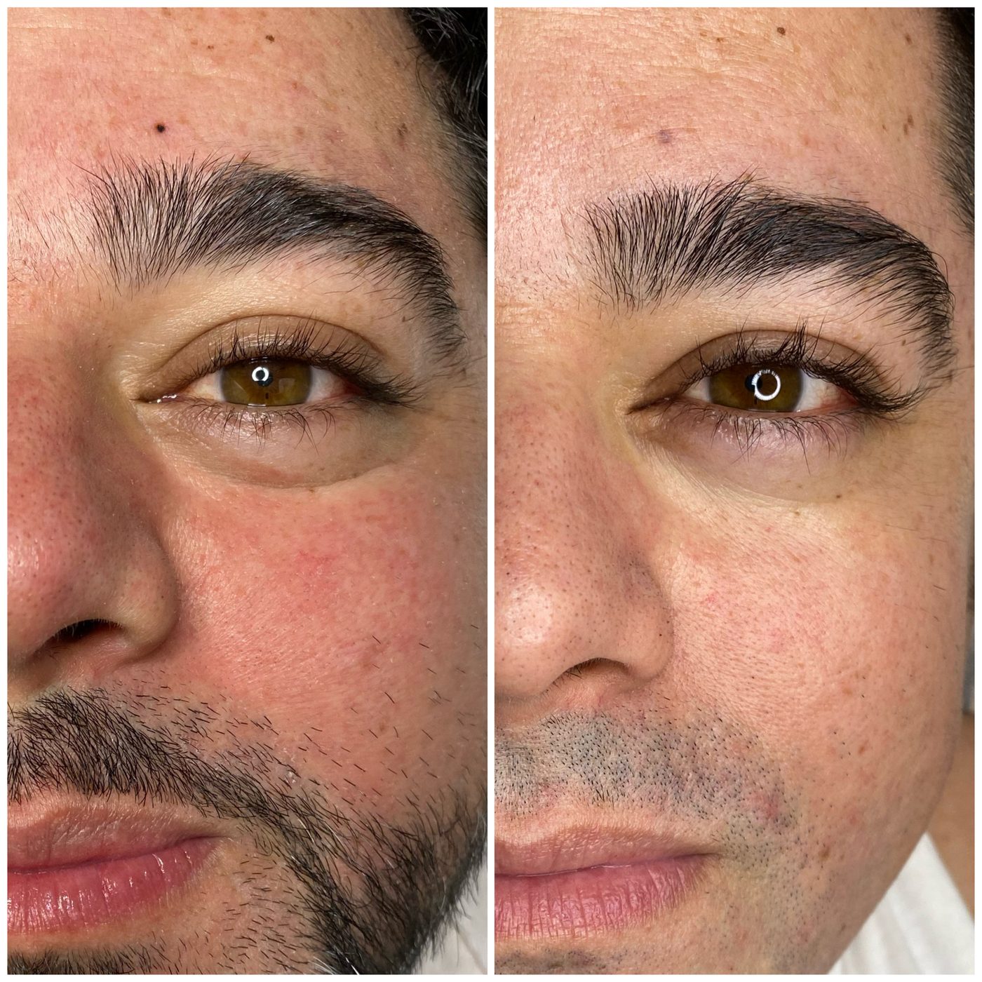 Resultado antes y despu&eacute;s — Cejas & Micropigmentaci&oacute;n
