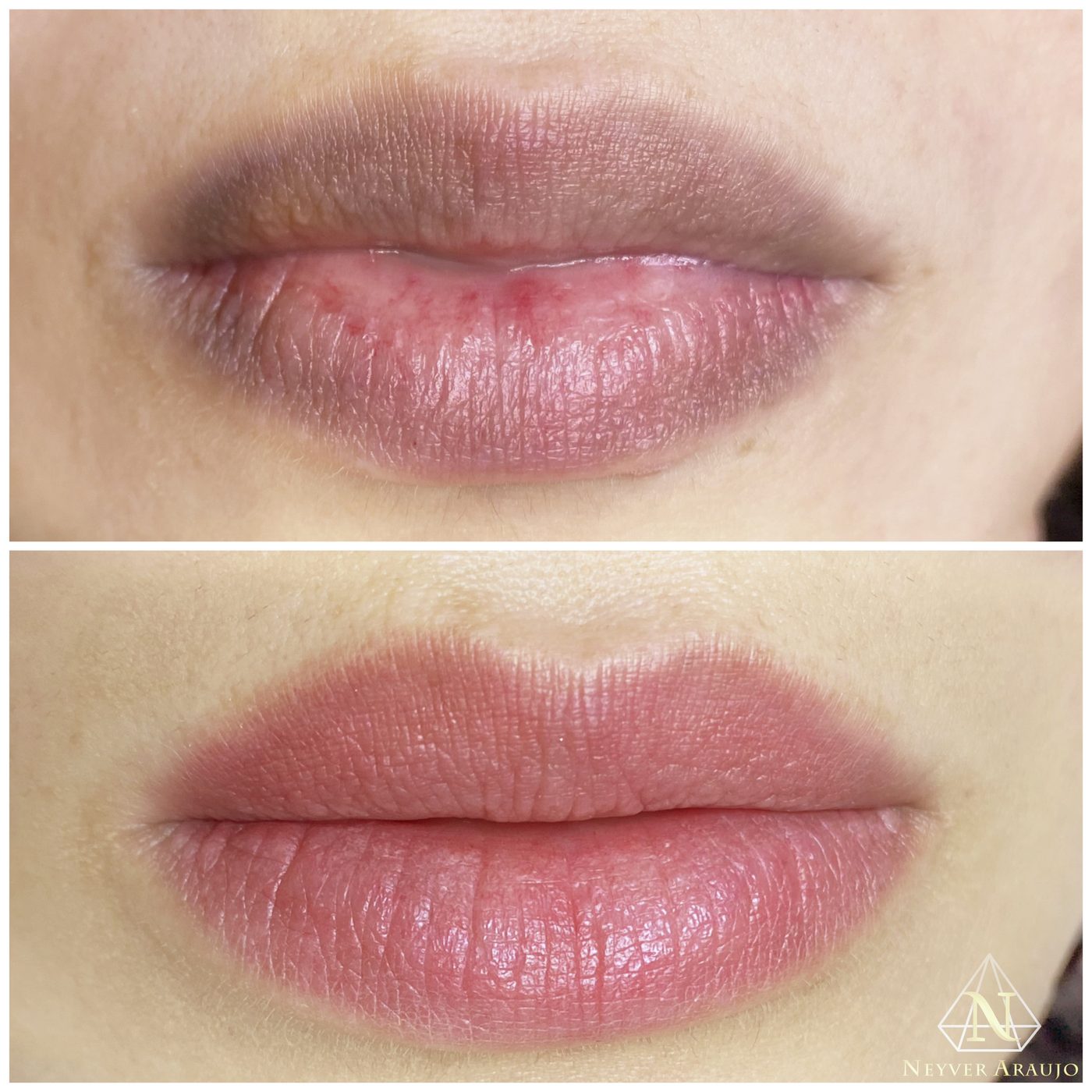Resultado antes y despu&eacute;s — Labios