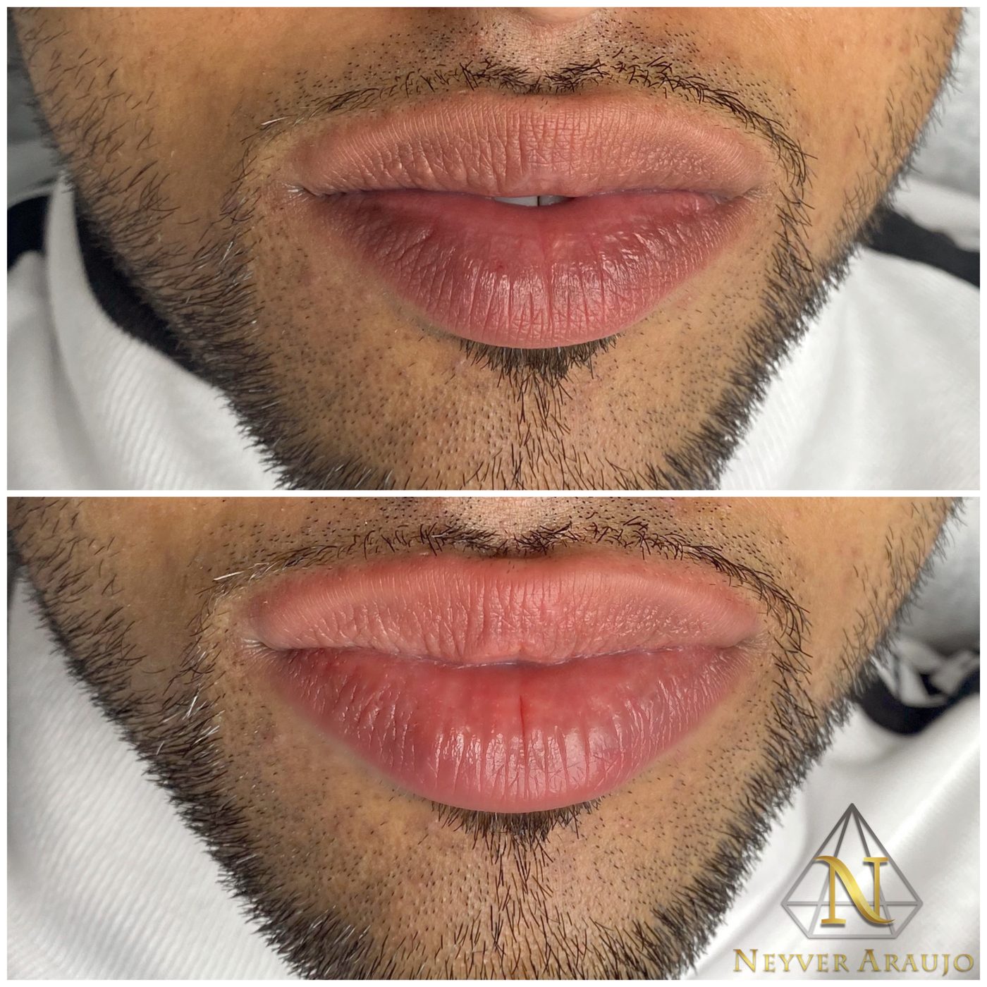 Resultado antes y despu&eacute;s — Cejas & Micropigmentaci&oacute;n